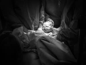  Is a Brachial Plexus Birth Injury Considered Medical Malpractice?
